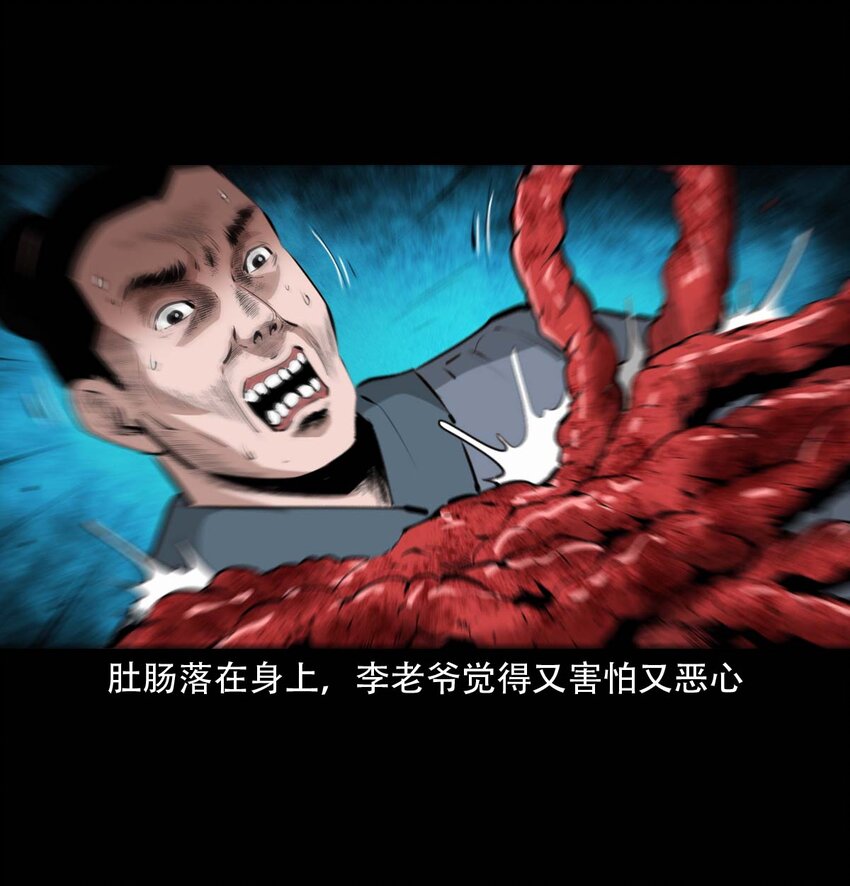 24 抽肠36