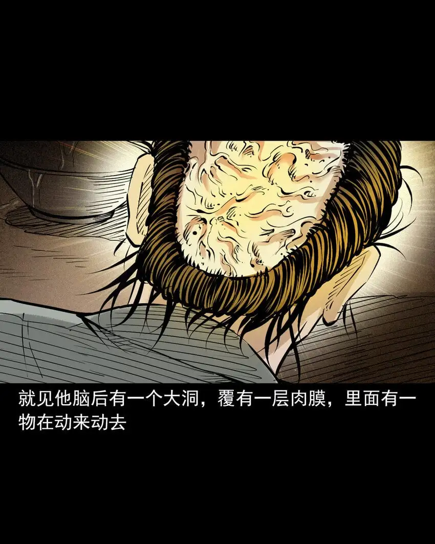109 第109话牛瘟15