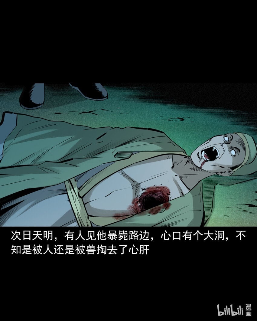 85 第85话换心41