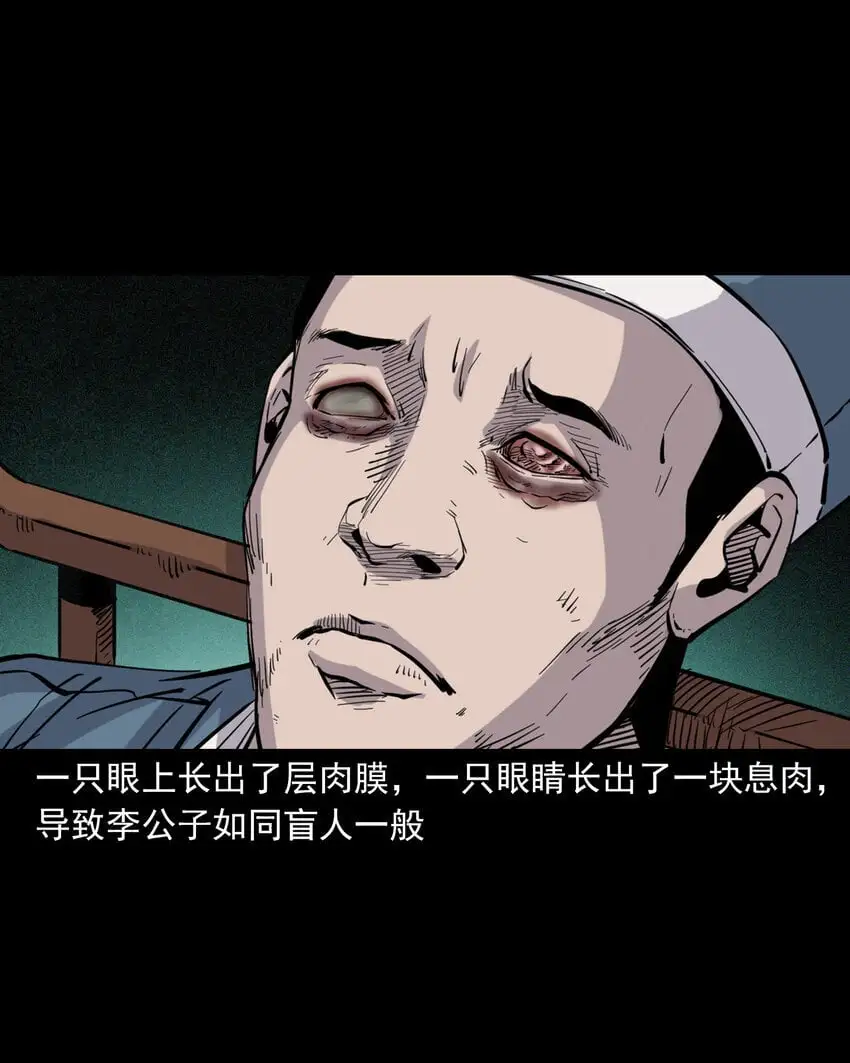 113 第113话双瞳13