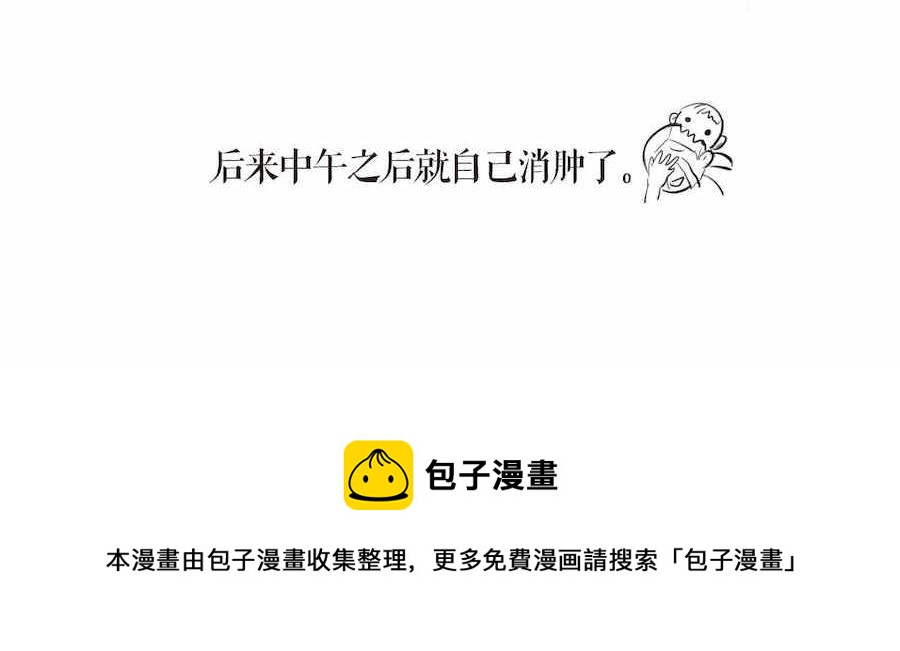 04 弟弟眼睛肿了12