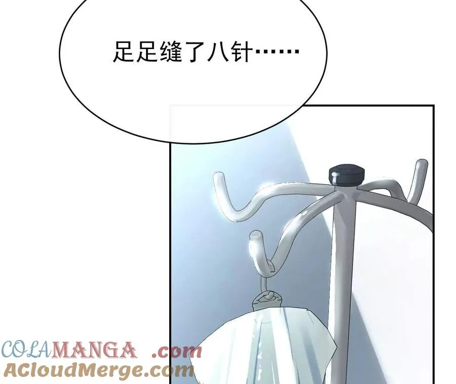 29 伤口80