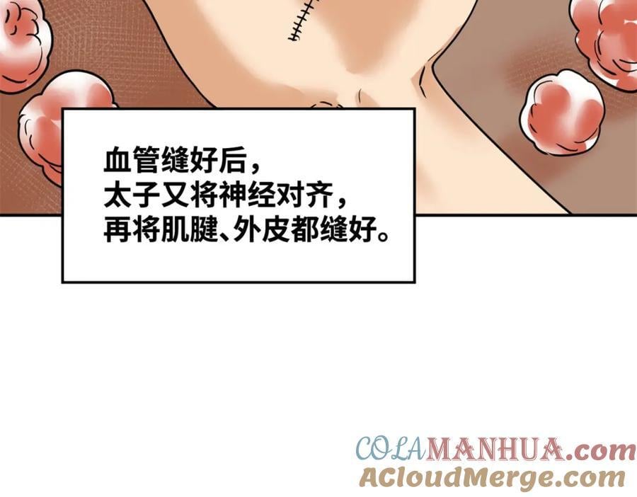 269 接掌手术33