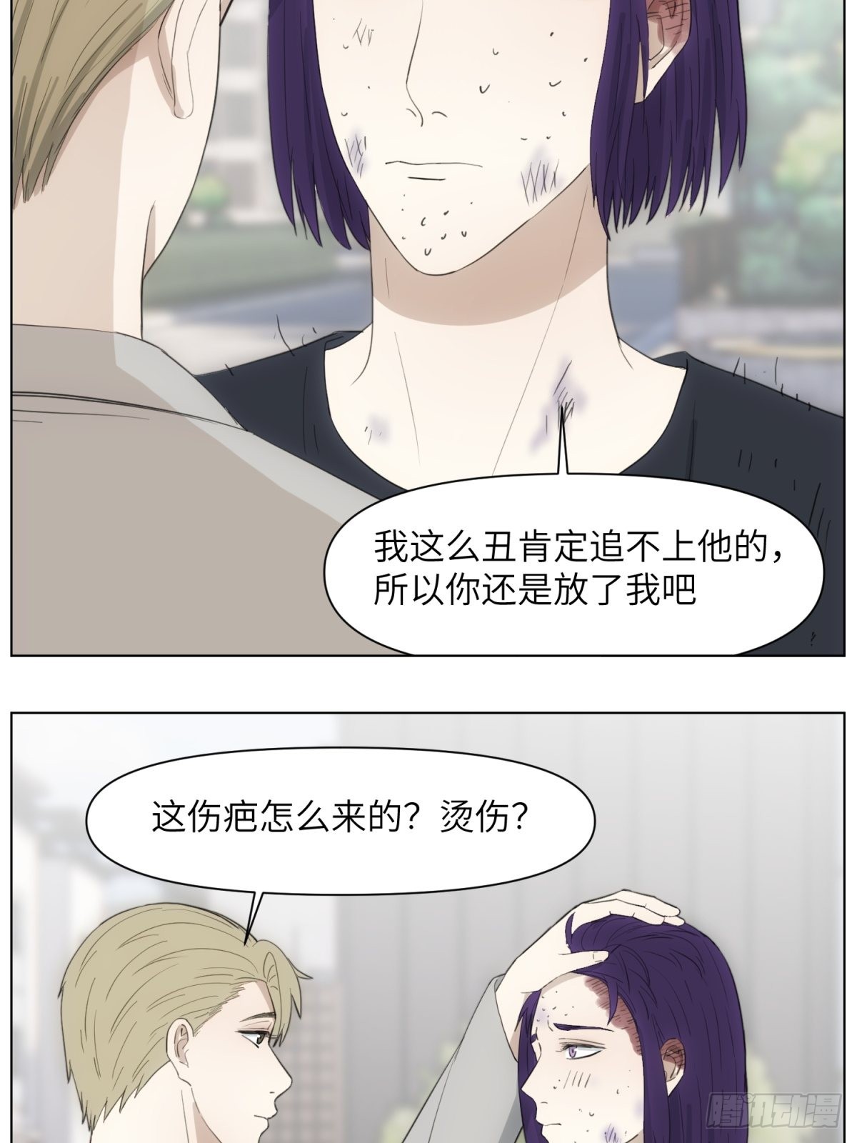 伤疤11