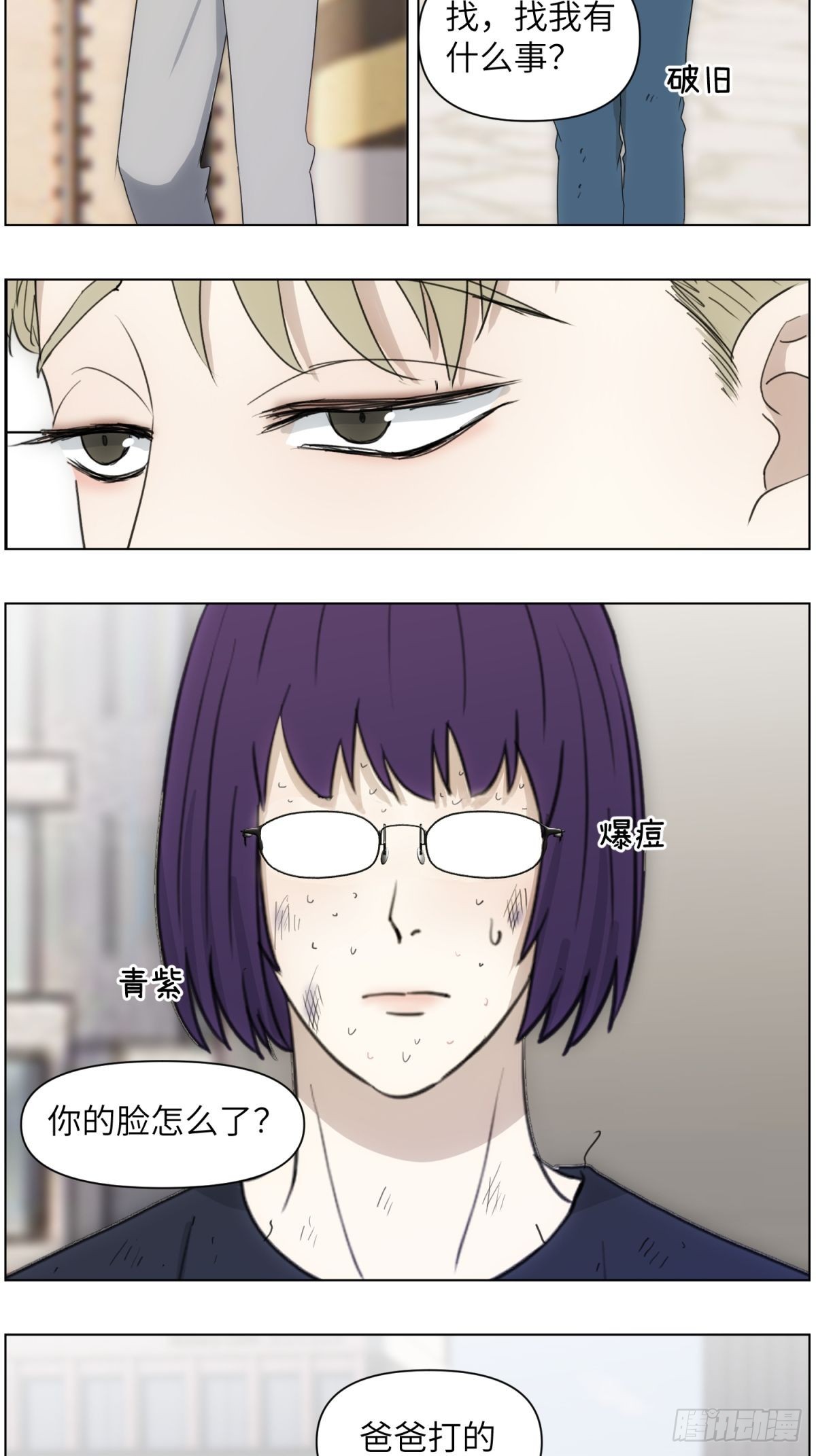 伤疤1