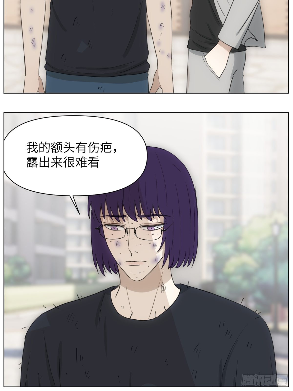 伤疤8