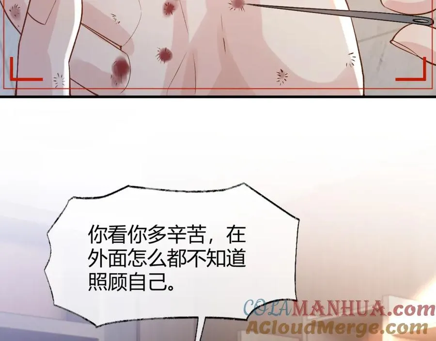 第26话 景总给修修揉手��！8