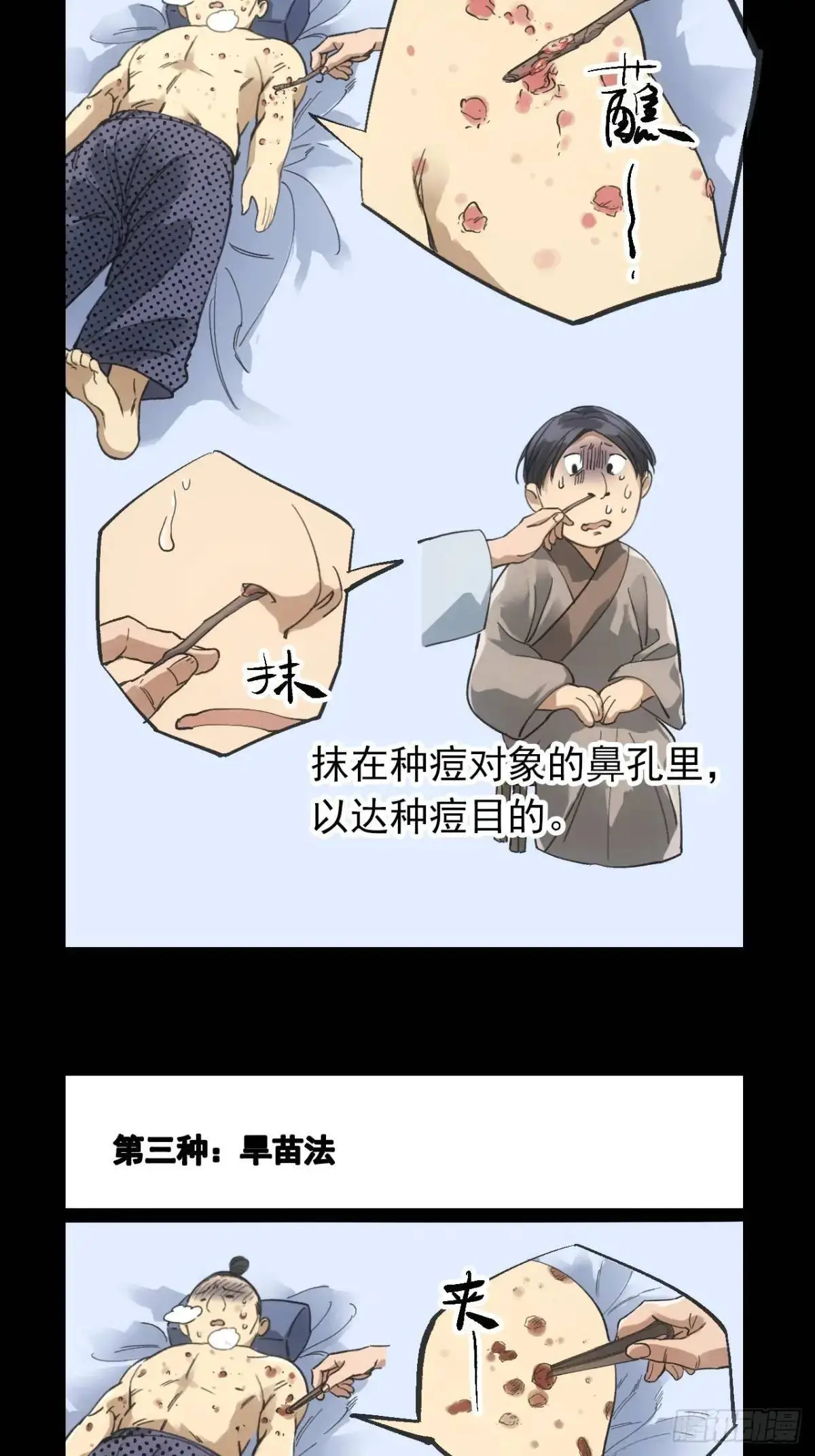 030种痘法27