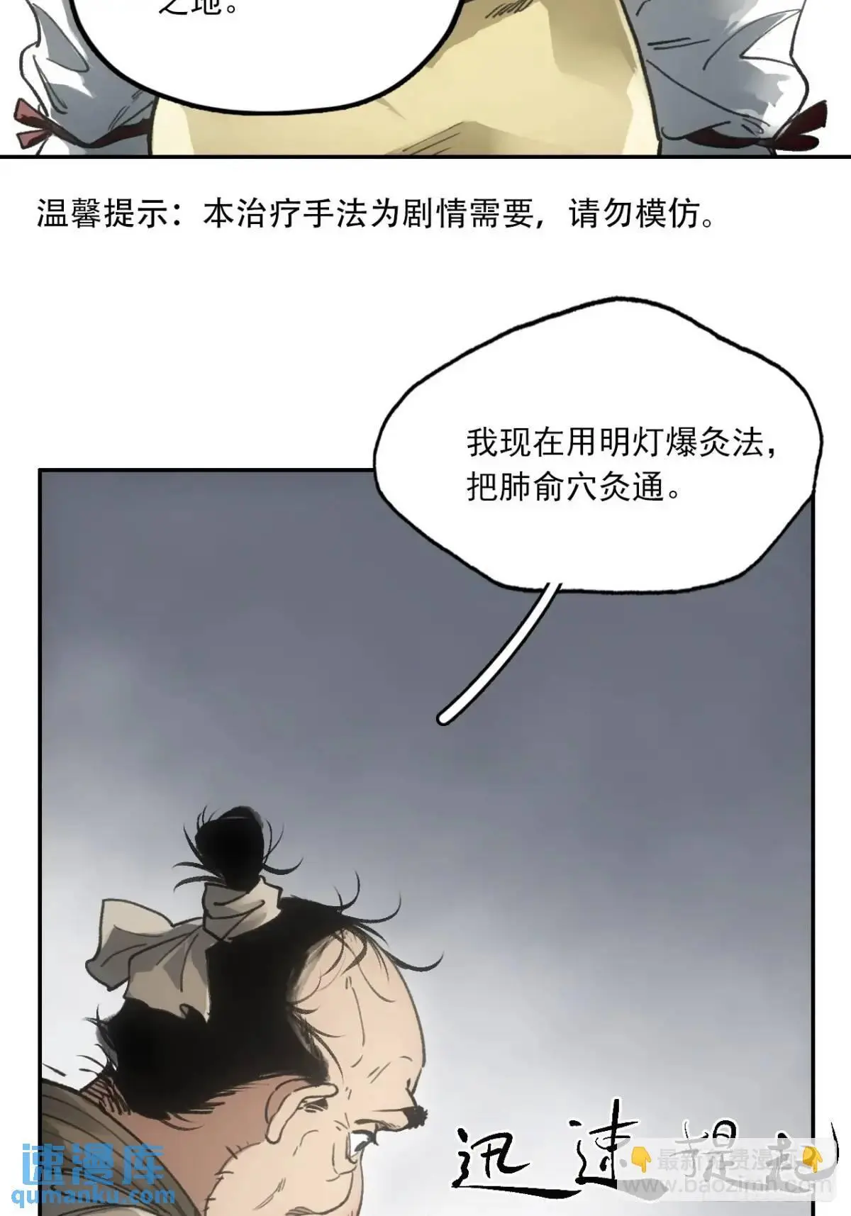 024灯火灸42