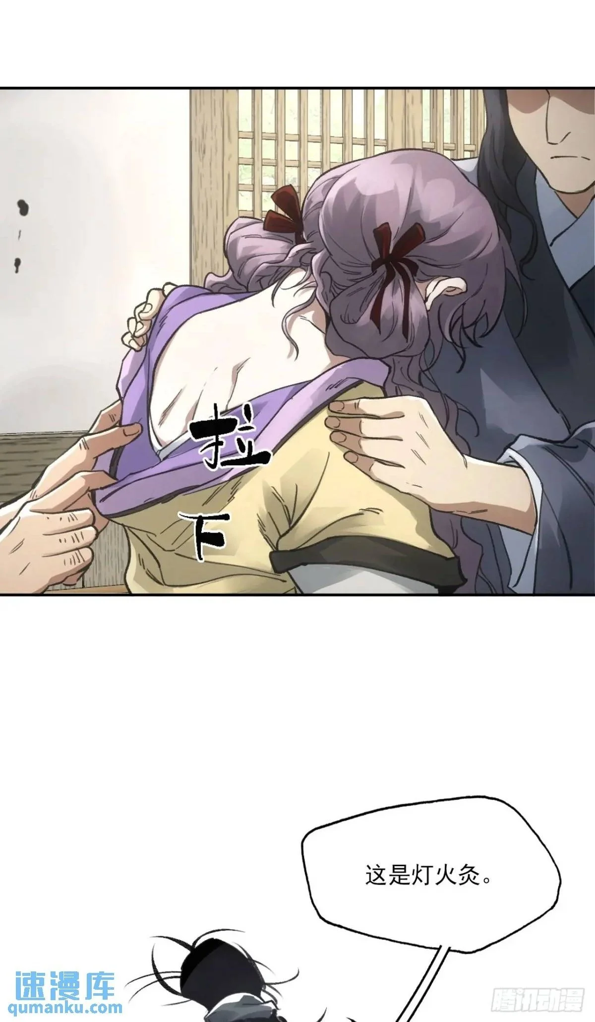 024灯火灸37