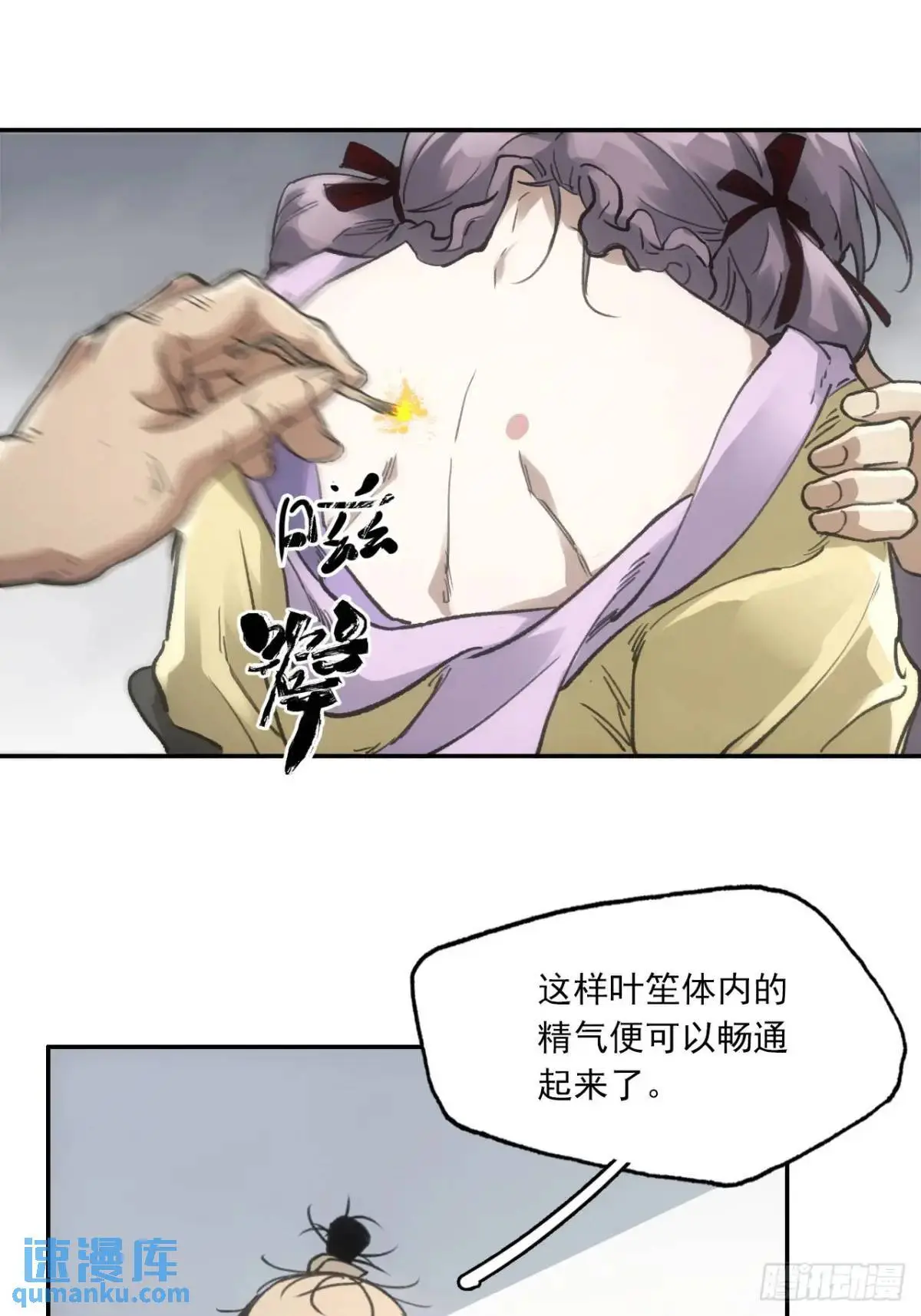 024灯火灸45