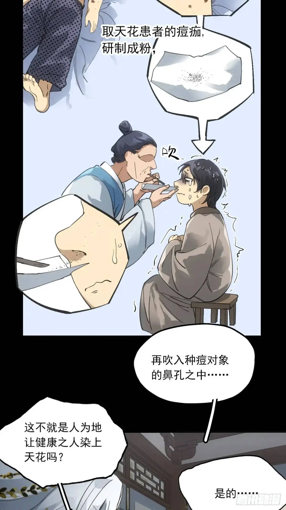 030种痘法28