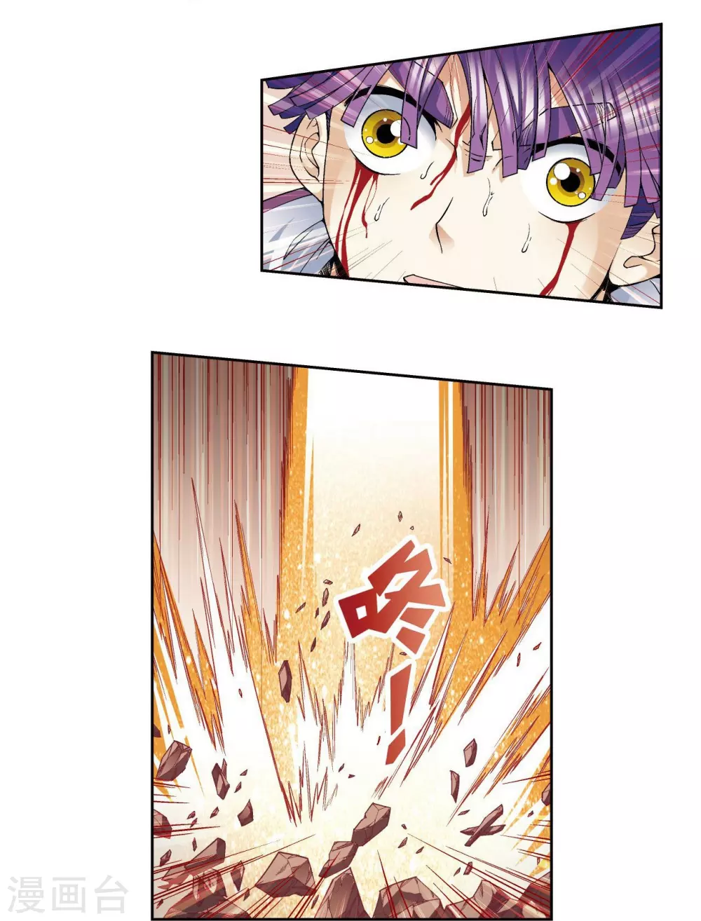 第116话 碎骨之痛18