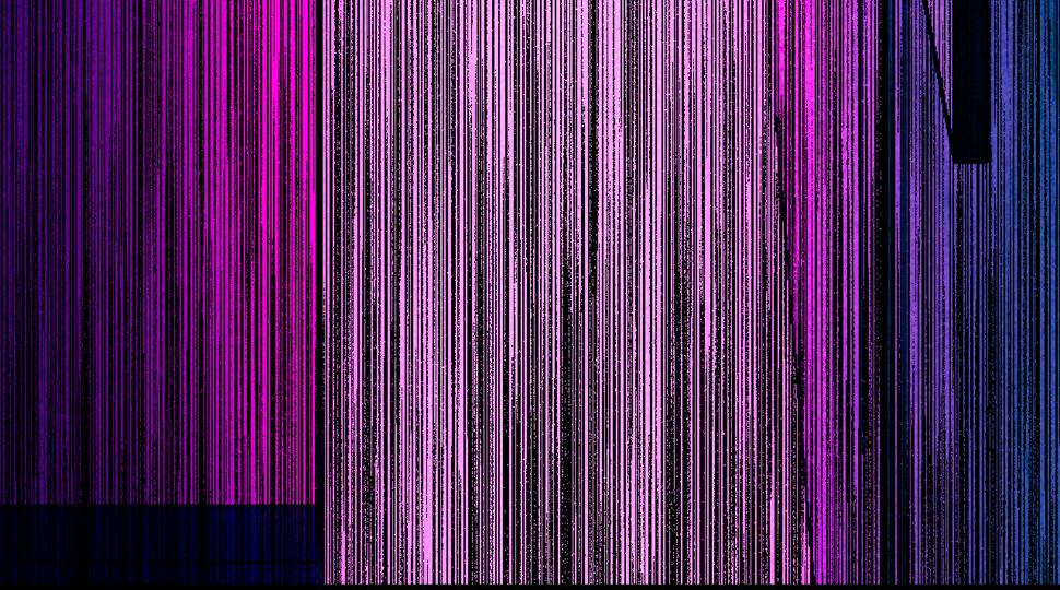 37-脐带绕颈98