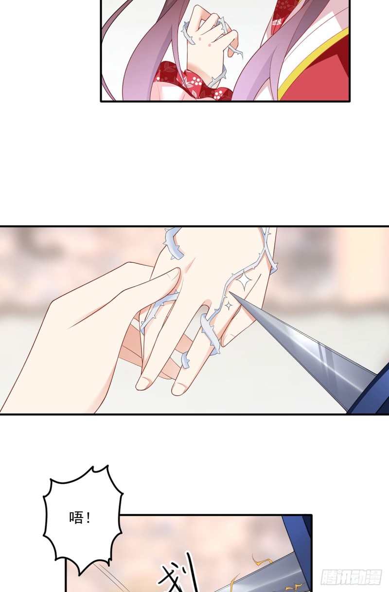 186.手术进行中21