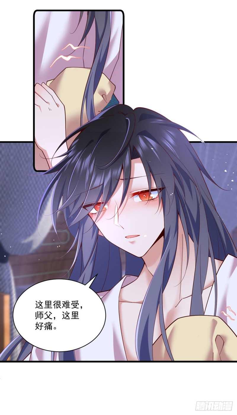 第313话 无法拒绝小渊渊15