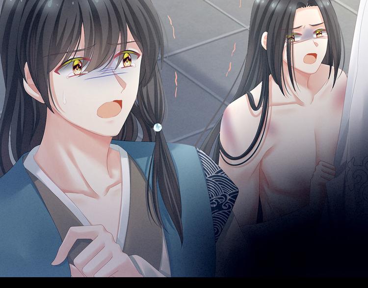 第100话 救救他！44