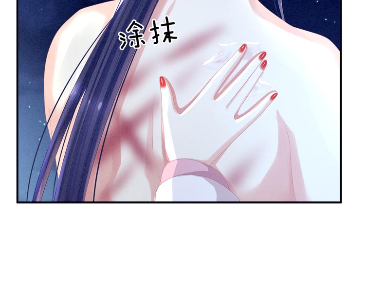 第15话 亲手上药17