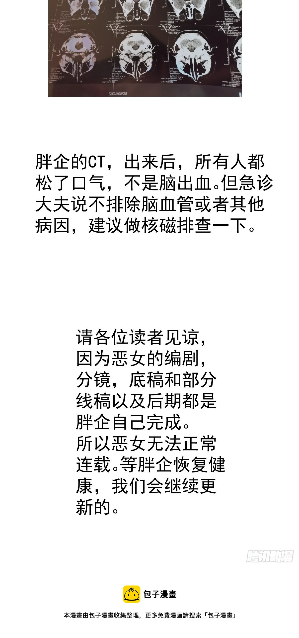 暂停更新通知2