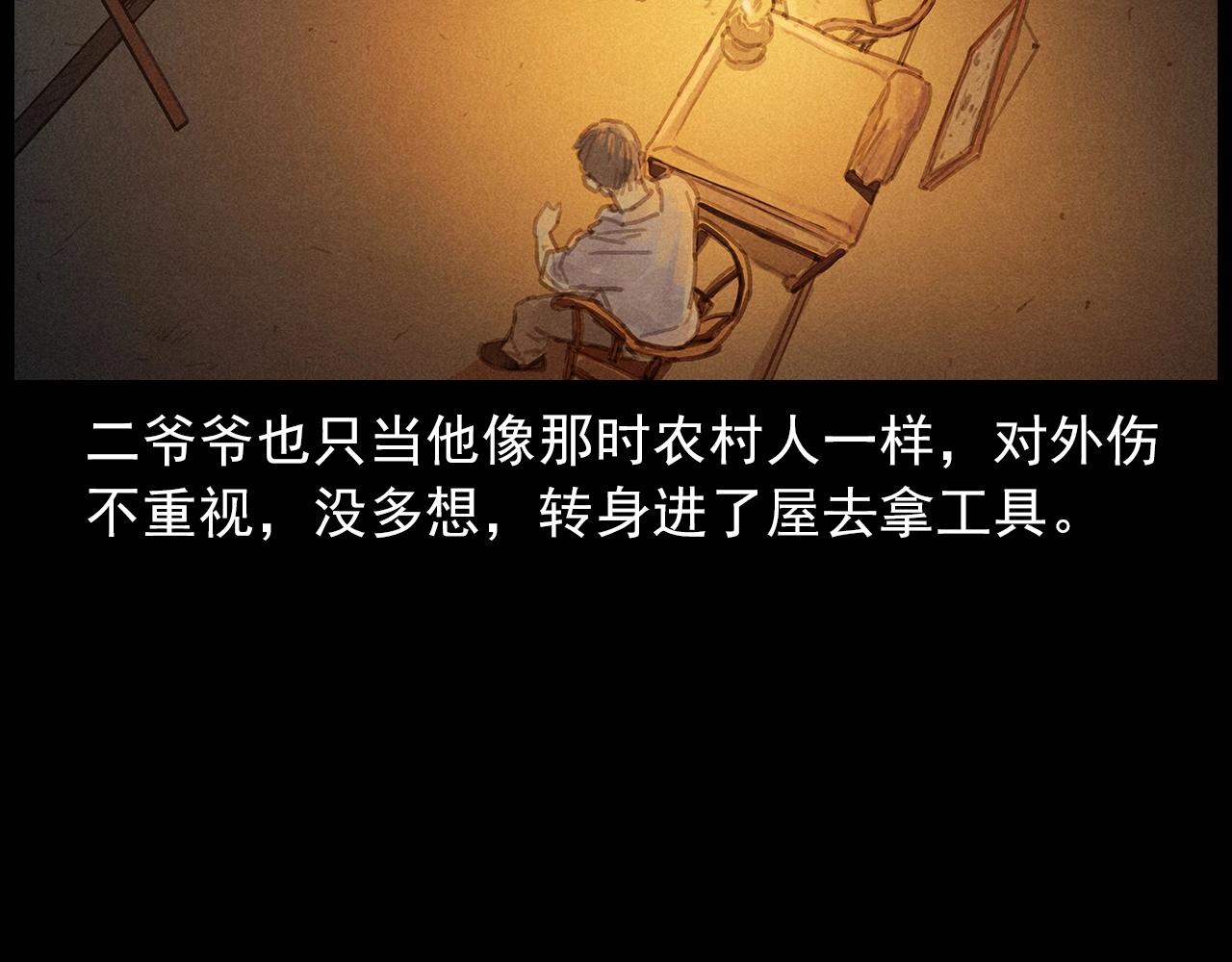 第434话 伤口27