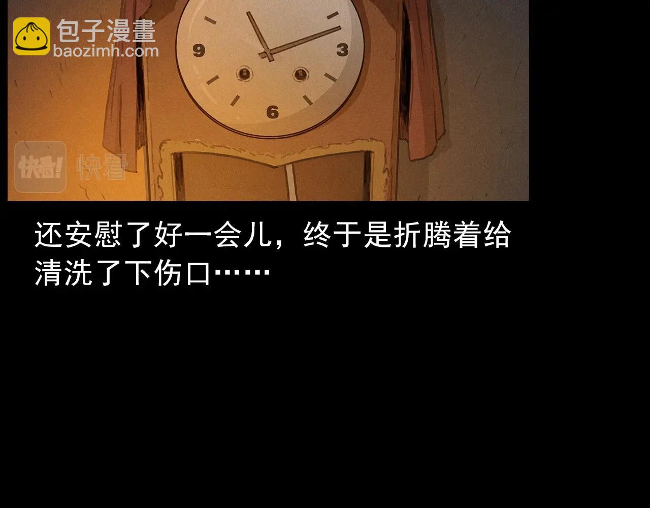 第434话 伤口30