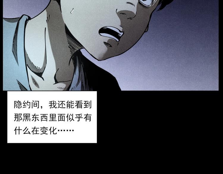 第287话 飞蚊症45