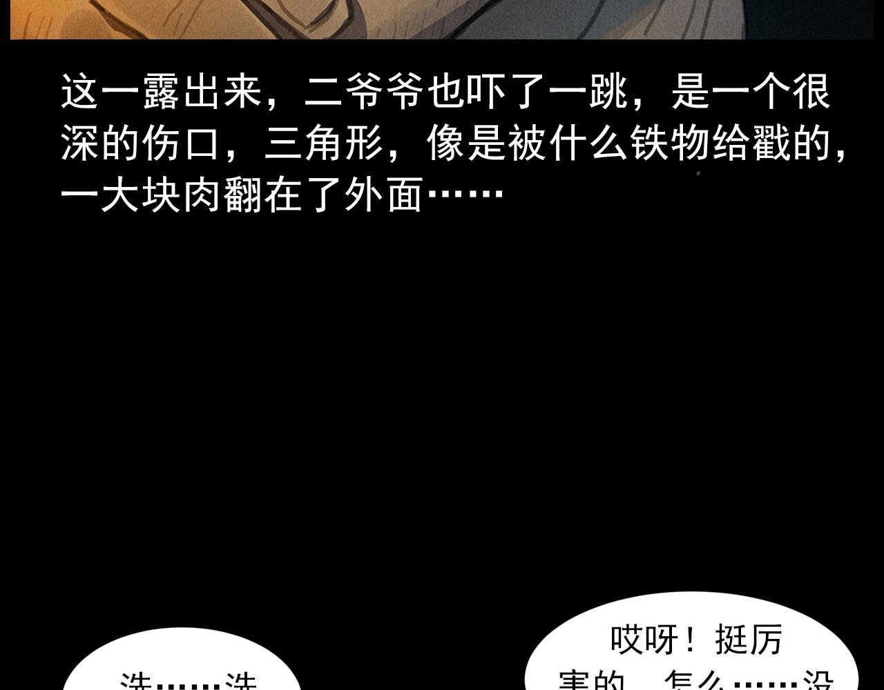 第434话 伤口19