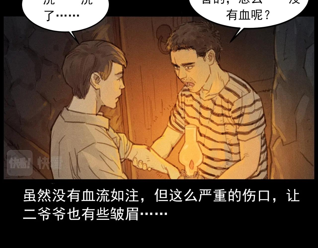 第434话 伤口20