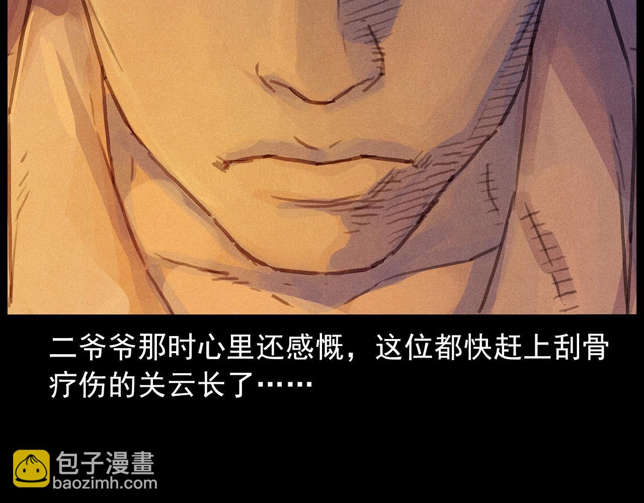 第434话 伤口38