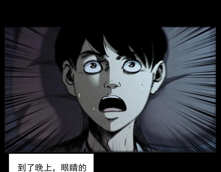第287话 飞蚊症55