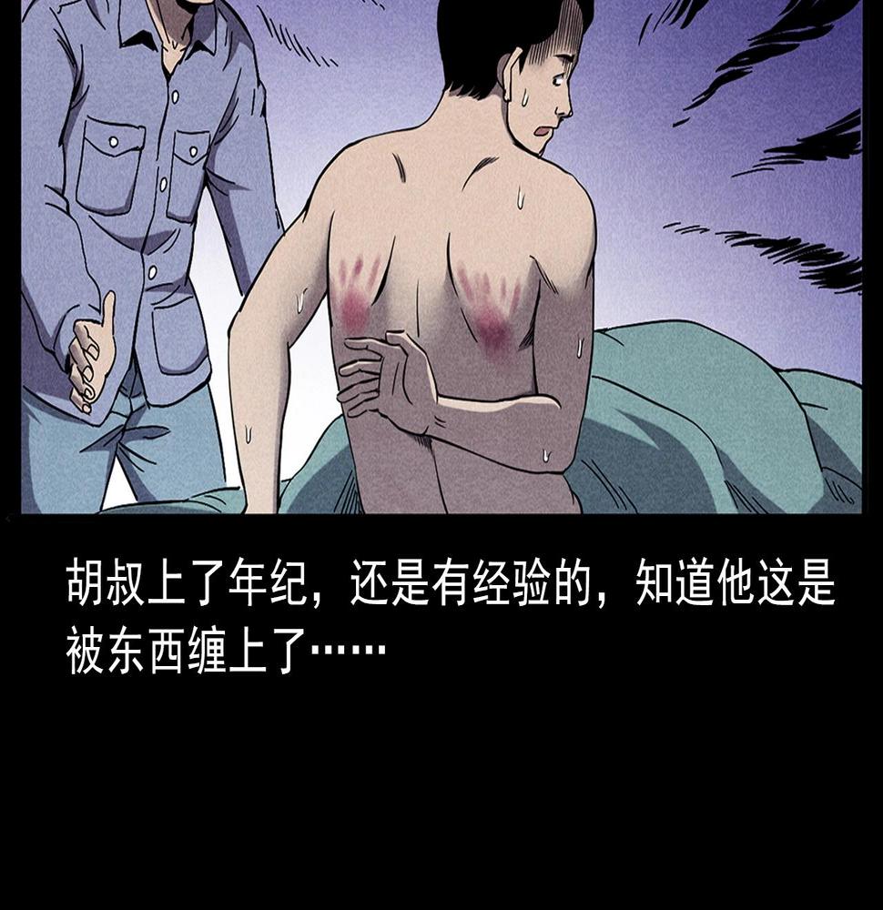 第417话 烈日灼身52