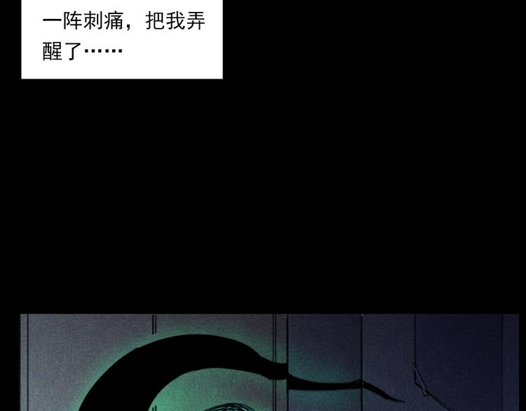 第287话 飞蚊症56