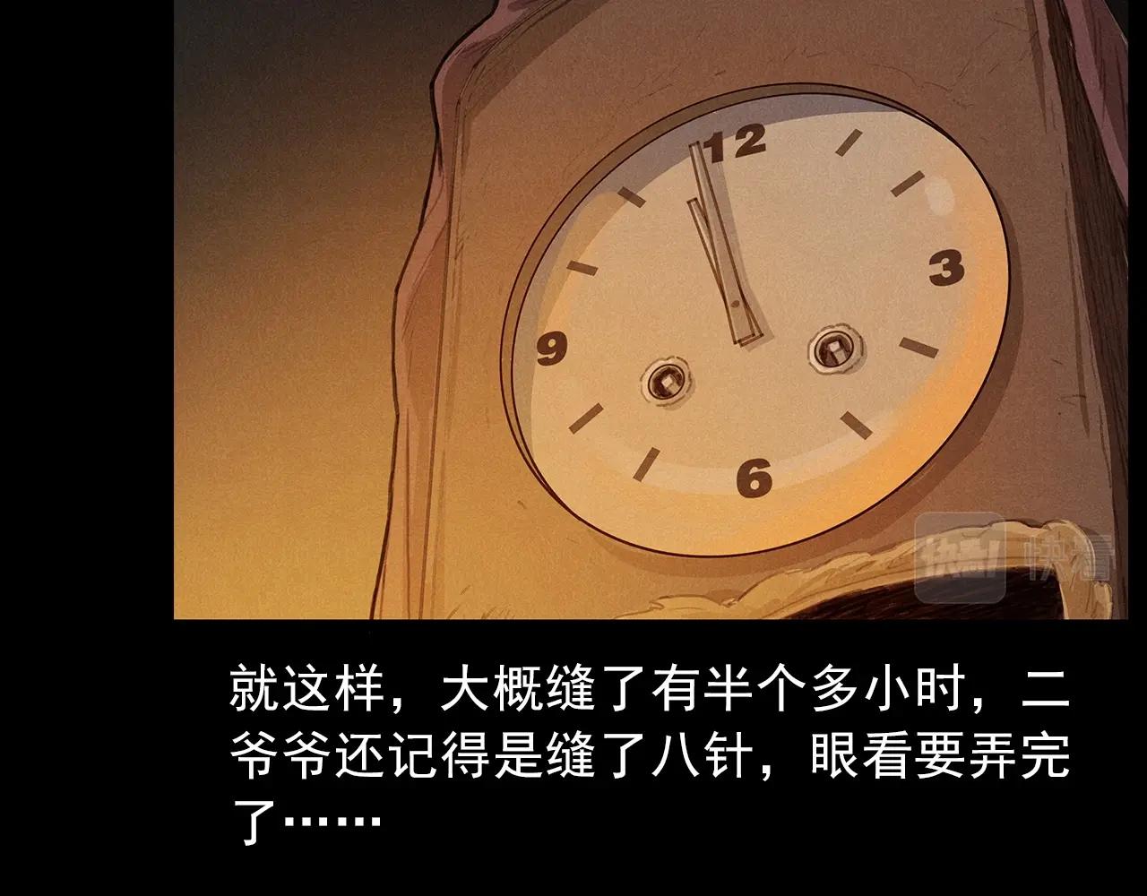 第434话 伤口43