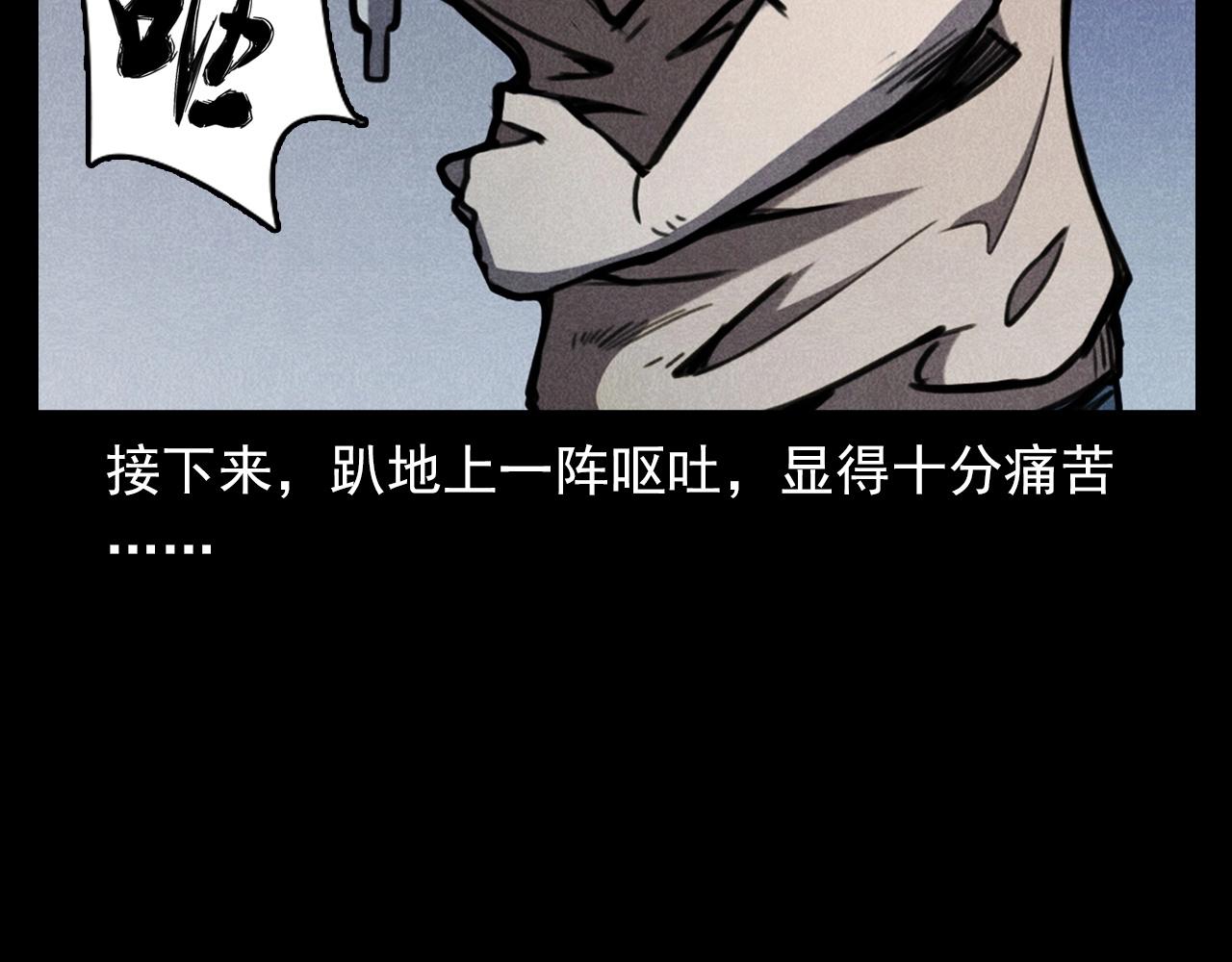 第343话 失忆57