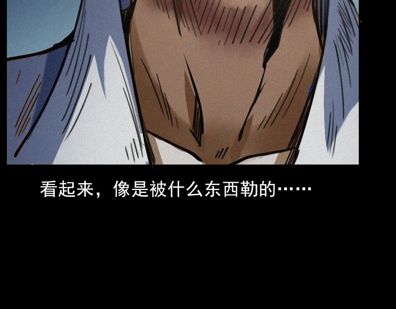第408话 宿醉75