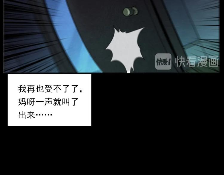 第287话 飞蚊症70