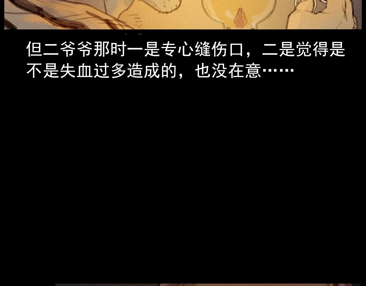 第434话 伤口42