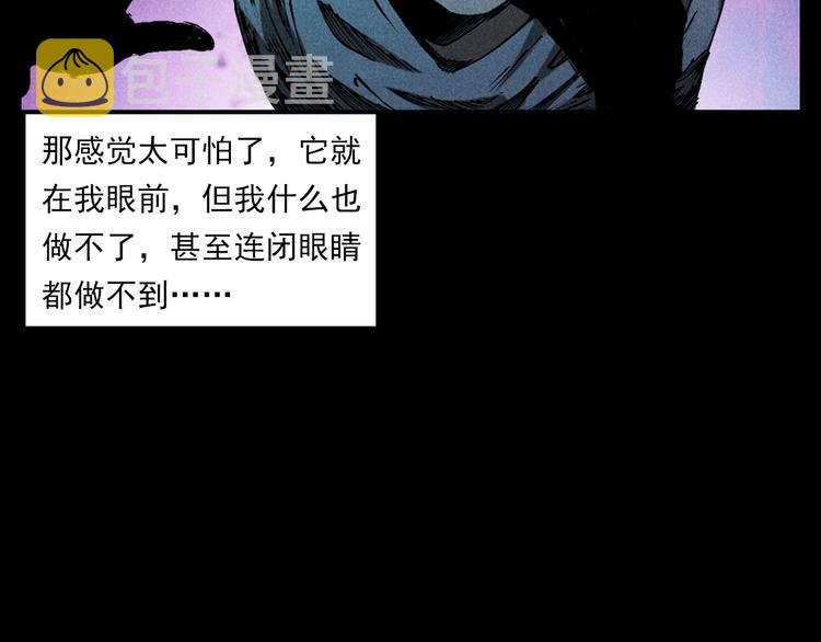 第287话 飞蚊症67