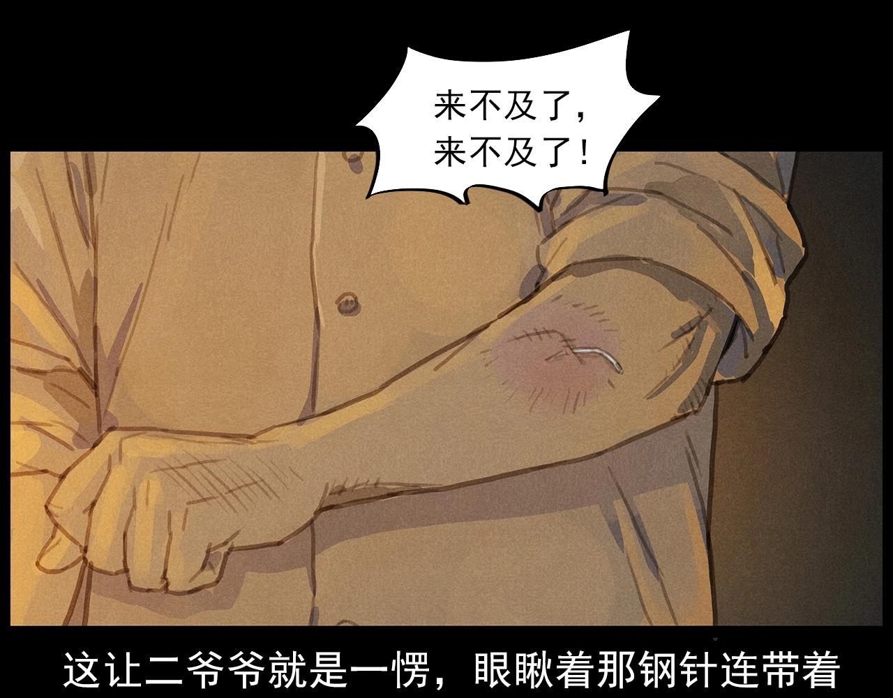第434话 伤口46