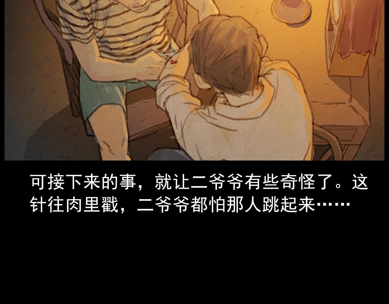 第434话 伤口34