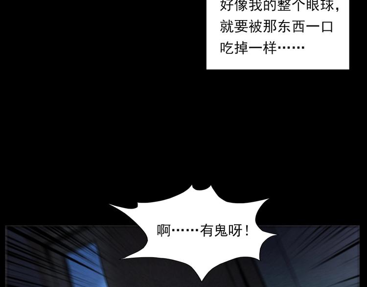 第287话 飞蚊症69