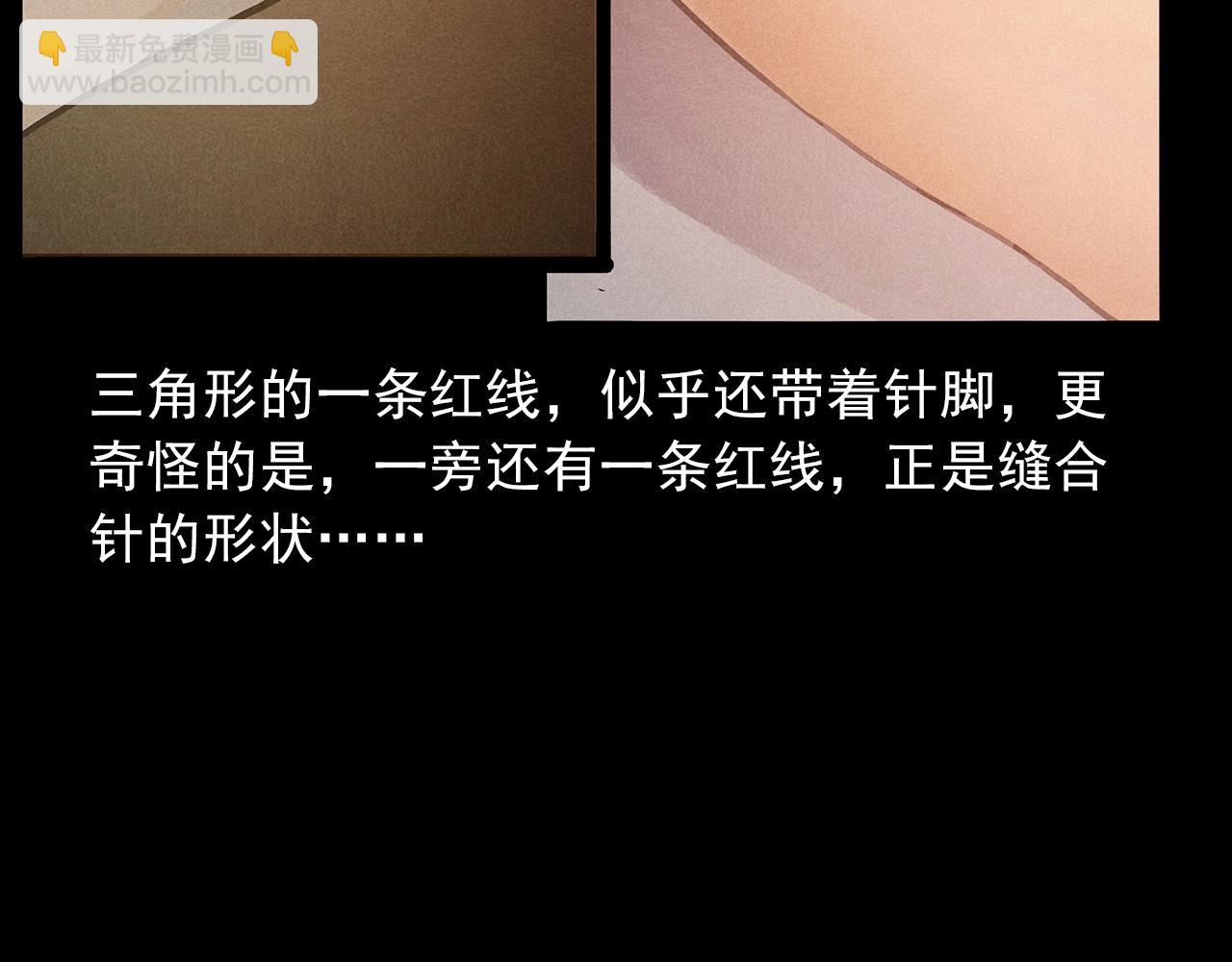 第434话 伤口74