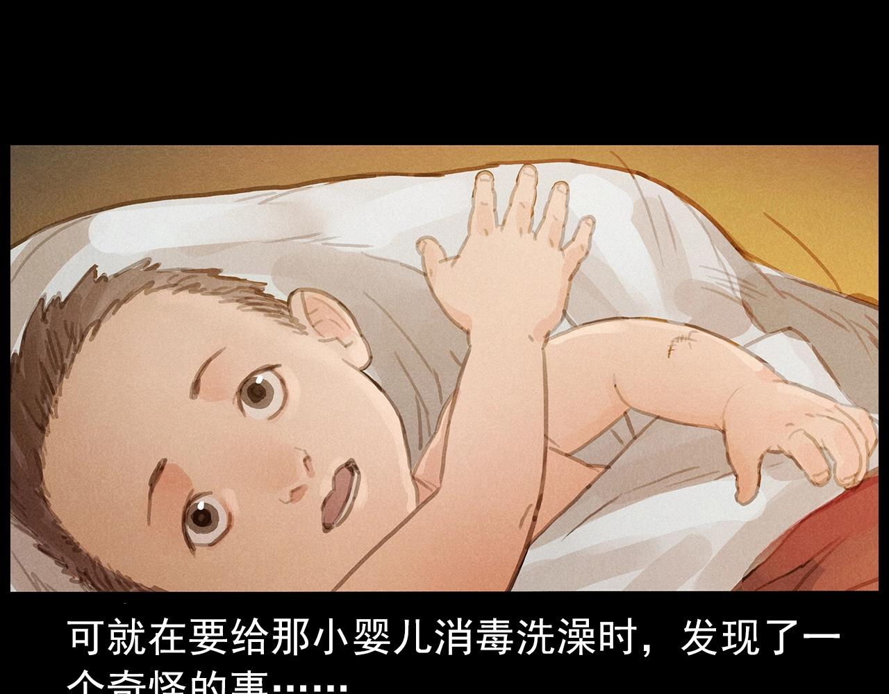 第434话 伤口70