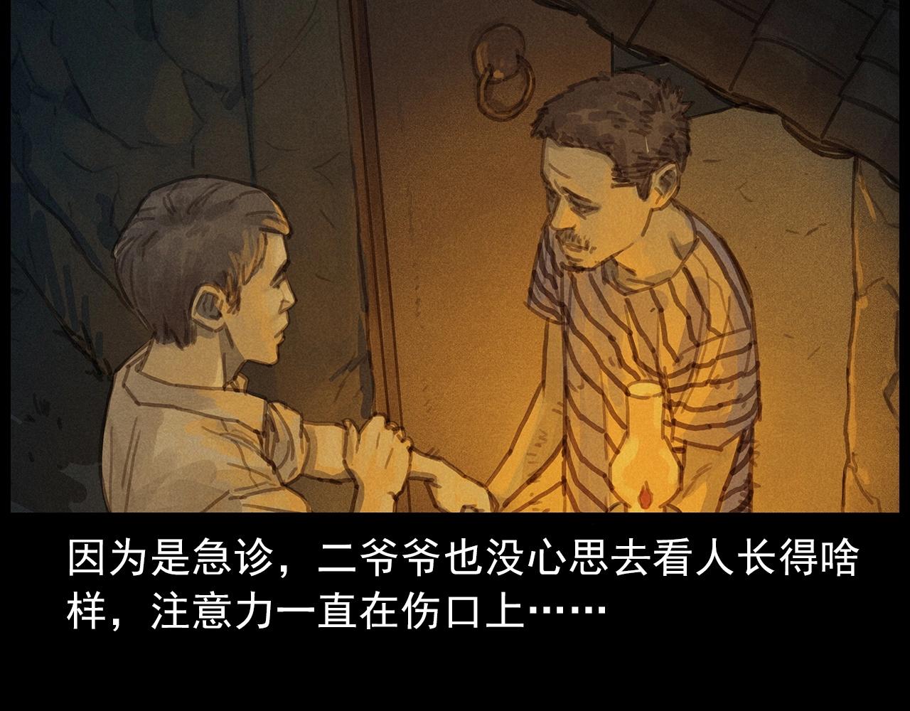 第434话 伤口15