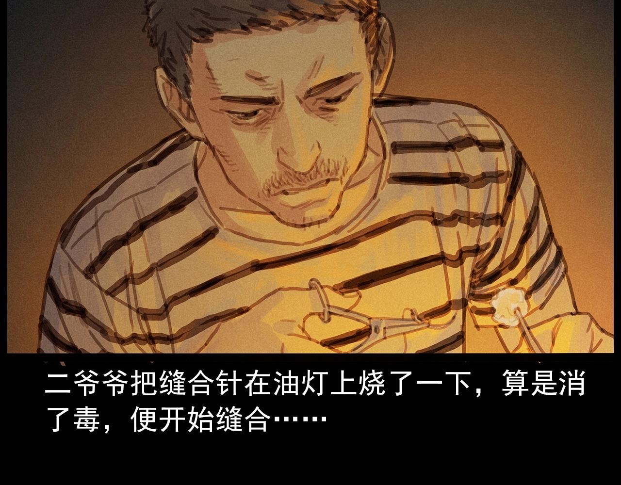 第434话 伤口32
