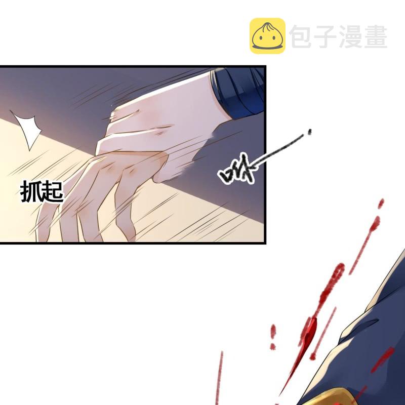 第107话31