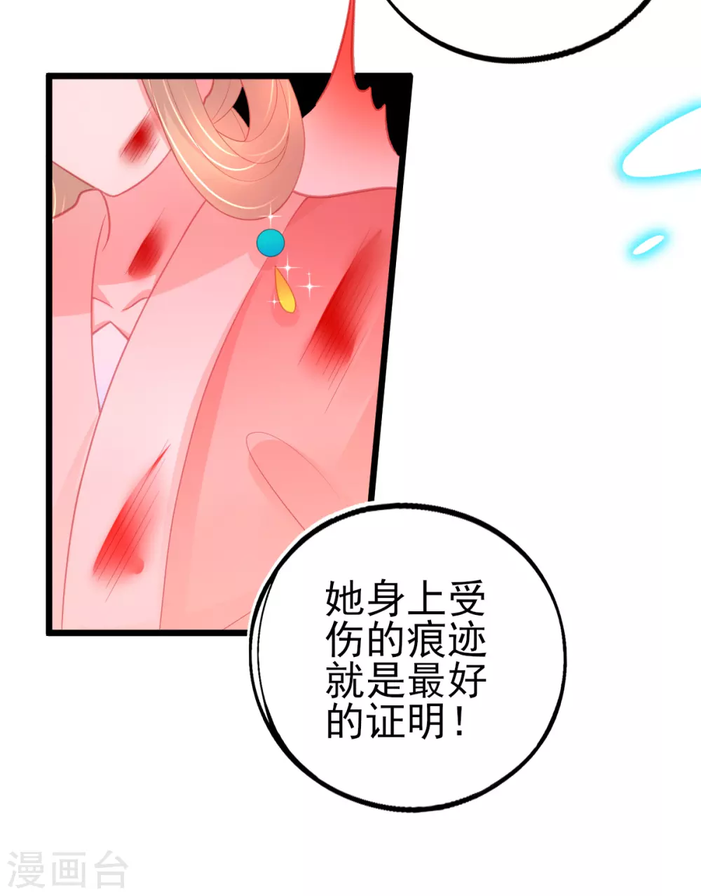 第114话 以牙还牙4