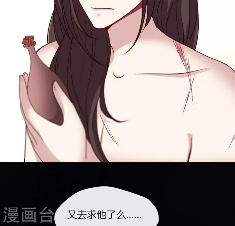 第83话 伤痕63