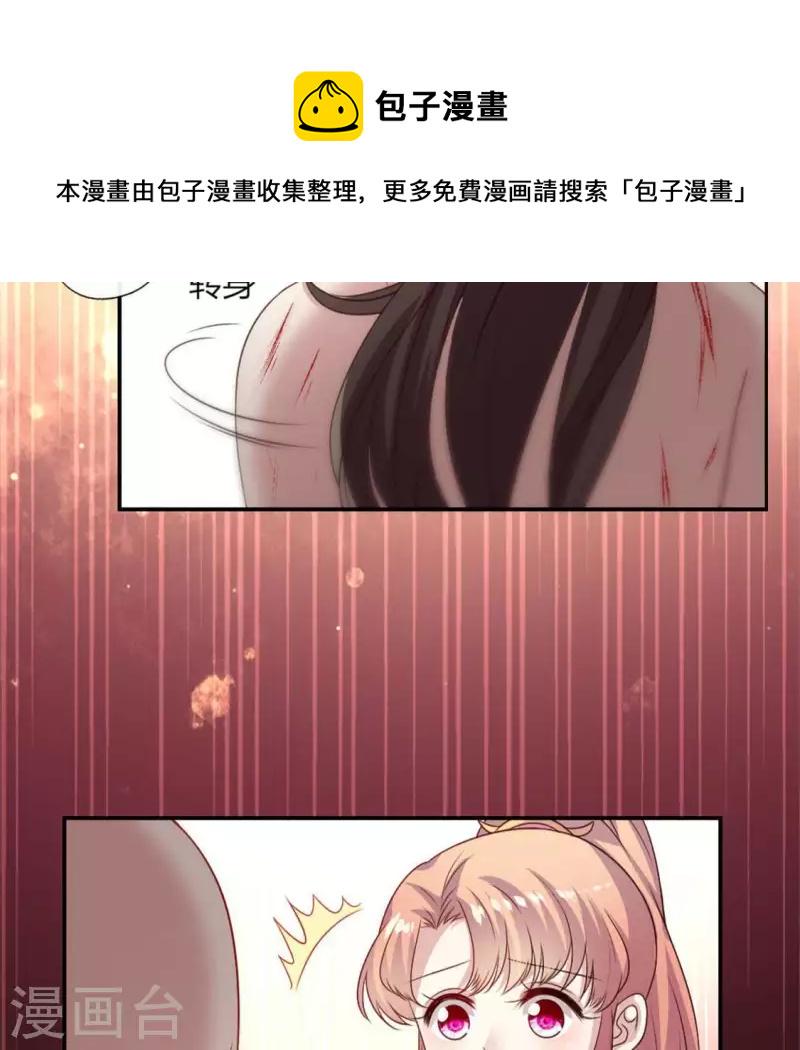 第83话 伤痕43