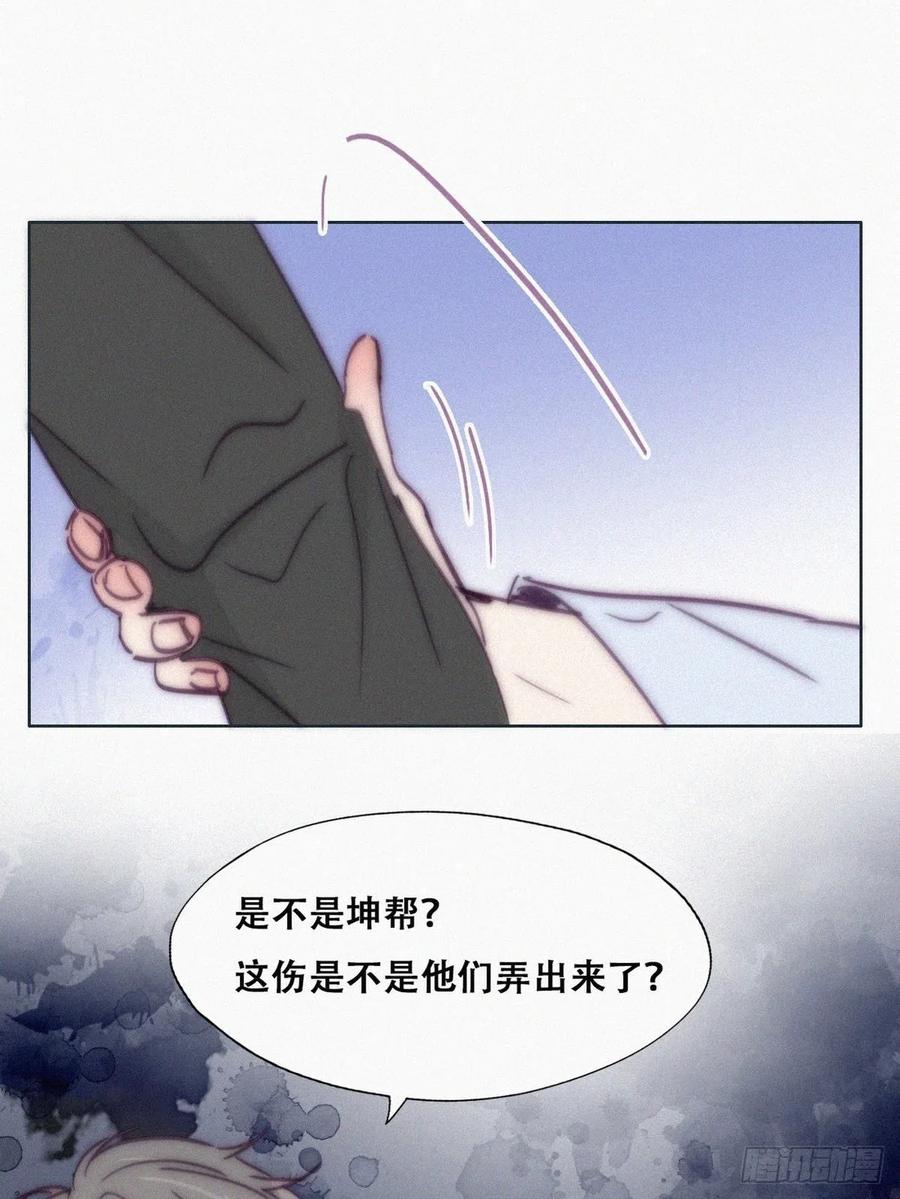 第144话 瞿城受伤44